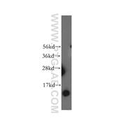 NDUFB3 Rabbit Polyclonal Antibody (12358-1-AP)
