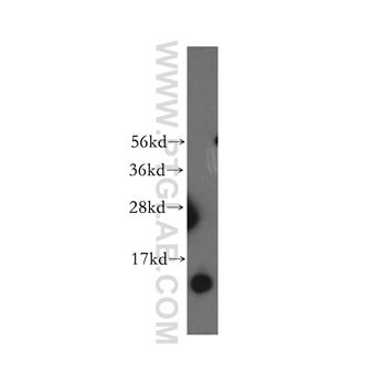 NDUFB3 Rabbit Polyclonal Antibody (12358-1-AP)