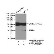 SEPT4 Rabbit Polyclonal Antibody (12476-1-AP)