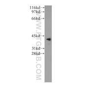 VASH1 Rabbit Polyclonal Antibody (12730-1-AP)