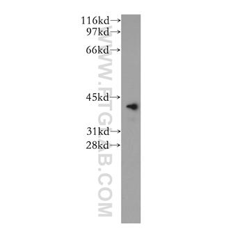 VASH1 Rabbit Polyclonal Antibody (12730-1-AP)
