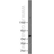 PI16 Rabbit Polyclonal Antibody (12267-1-AP)