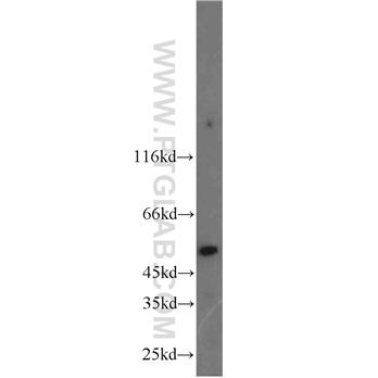PI16 Rabbit Polyclonal Antibody (12267-1-AP)