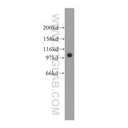 SALL2 Rabbit Polyclonal Antibody (12679-1-AP)