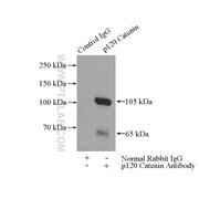 CTNND1 Rabbit Polyclonal Antibody (12180-1-AP)