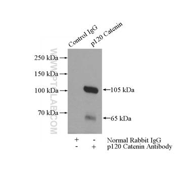 CTNND1 Rabbit Polyclonal Antibody (12180-1-AP)