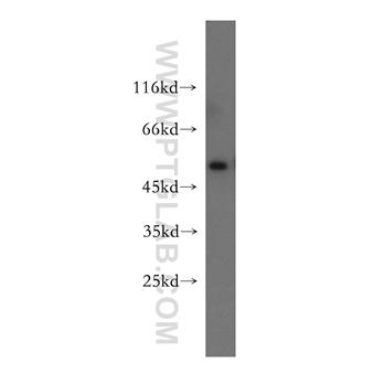 TYMP Rabbit Polyclonal Antibody (12383-1-AP)