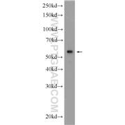 KPNA4 Rabbit Polyclonal Antibody (12463-1-AP)