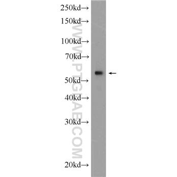 KPNA4 Rabbit Polyclonal Antibody (12463-1-AP)