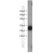 EXOSC1 Rabbit Polyclonal Antibody (12585-1-AP)