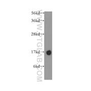 CST3 Rabbit Polyclonal Antibody (12245-1-AP)