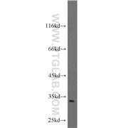 SLC25A11 Rabbit Polyclonal Antibody (12253-1-AP)