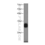 RGS17 Rabbit Polyclonal Antibody (12549-1-AP)
