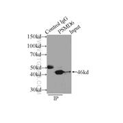 PSMD6 Rabbit Polyclonal Antibody (12539-1-AP)