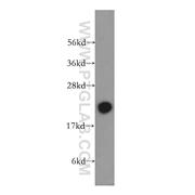 RBBP9 Rabbit Polyclonal Antibody (12230-2-AP)
