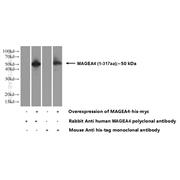 MAGEA4 Rabbit Polyclonal Antibody (12508-1-AP)
