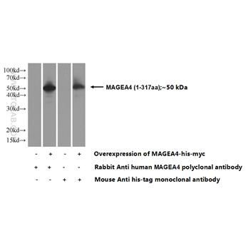 MAGEA4 Rabbit Polyclonal Antibody (12508-1-AP)
