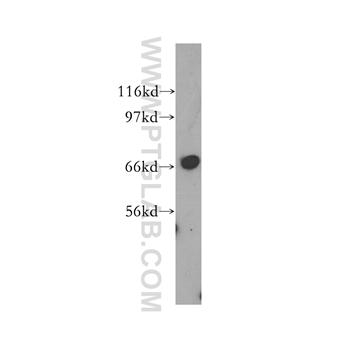 SCFD1 Rabbit Polyclonal Antibody (12569-1-AP)