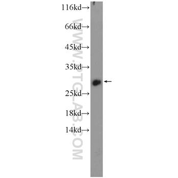 HOXB7 Rabbit Polyclonal Antibody (12613-1-AP)