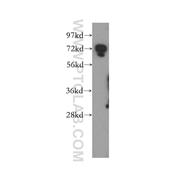 DYNC1I2 Rabbit Polyclonal Antibody (12219-1-AP)