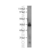 NEK11 Rabbit Polyclonal Antibody (12710-1-AP)