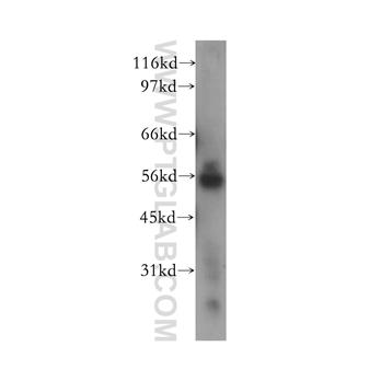NEK11 Rabbit Polyclonal Antibody (12710-1-AP)