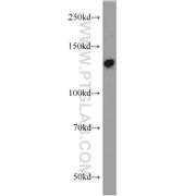 SFRS14 Rabbit Polyclonal Antibody (12514-1-AP)