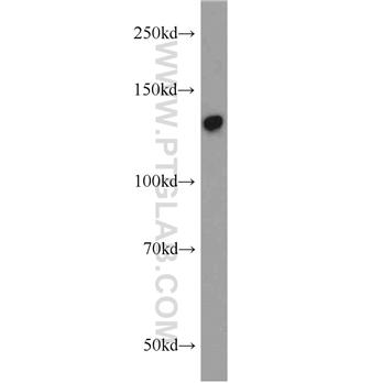SFRS14 Rabbit Polyclonal Antibody (12514-1-AP)