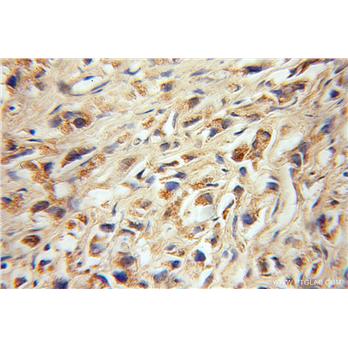 KIF1C Rabbit Polyclonal Antibody (12760-1-AP)