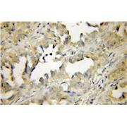 PEPD Rabbit Polyclonal Antibody (12218-1-AP)