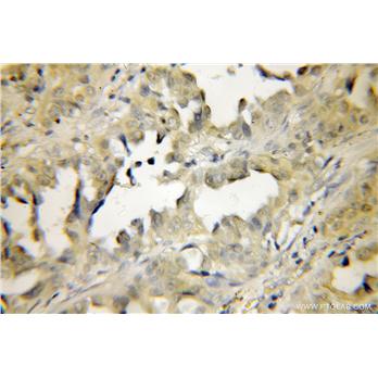 PEPD Rabbit Polyclonal Antibody (12218-1-AP)