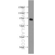 GPRASP2 Rabbit Polyclonal Antibody (12159-1-AP)