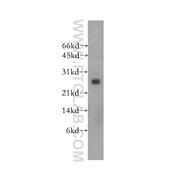 HEBP2 Rabbit Polyclonal Antibody (12706-1-AP)