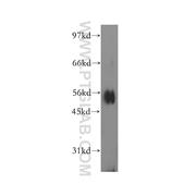 IPPK Rabbit Polyclonal Antibody (12603-1-AP)
