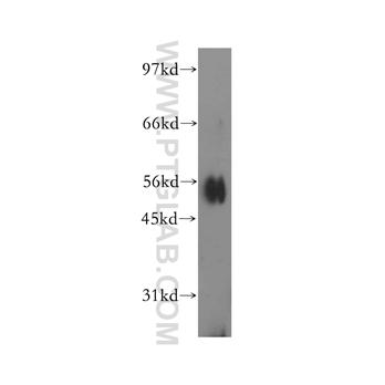 IPPK Rabbit Polyclonal Antibody (12603-1-AP)