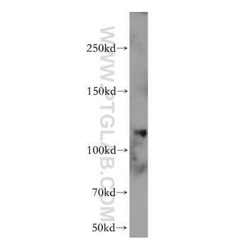 EIF3C Rabbit Polyclonal Antibody (12733-1-AP)