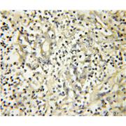 NXT2 Rabbit Polyclonal Antibody (12136-1-AP)