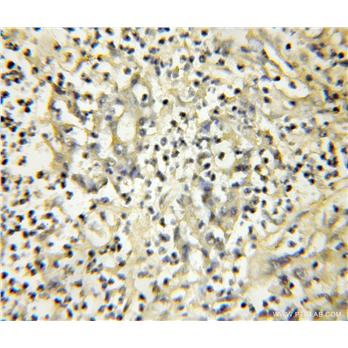 NXT2 Rabbit Polyclonal Antibody (12136-1-AP)