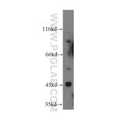 TRIM39 Rabbit Polyclonal Antibody (12757-1-AP)