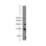 CYB5A Rabbit Polyclonal Antibody (12365-1-AP)