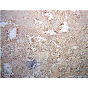 FUT8 Rabbit Polyclonal Antibody (12560-1-AP)