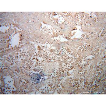 FUT8 Rabbit Polyclonal Antibody (12560-1-AP)