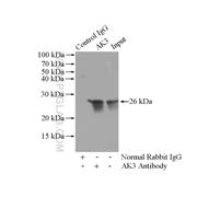 AK3 Rabbit Polyclonal Antibody (12562-1-AP)