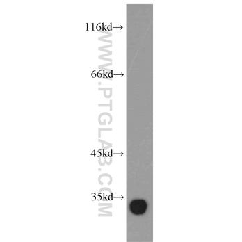 EFNA3 Rabbit Polyclonal Antibody (12480-1-AP)