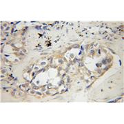 CDCA8 Rabbit Polyclonal Antibody (12465-1-AP)