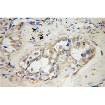 CDCA8 Rabbit Polyclonal Antibody (12465-1-AP)