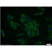 MTMR8 Rabbit Polyclonal Antibody (12299-1-AP)