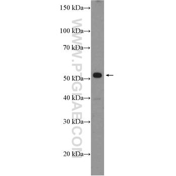 PDE9A Rabbit Polyclonal Antibody (12648-1-AP)