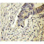 DPH2 Rabbit Polyclonal Antibody (12367-1-AP)