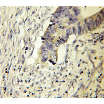 DPH2 Rabbit Polyclonal Antibody (12367-1-AP)